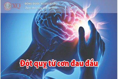 Đột quỵ từ cơn đau đầu 